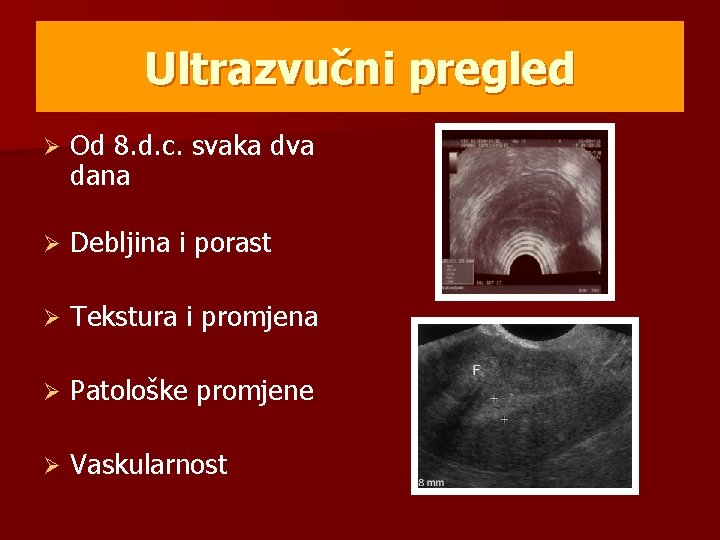 Ultrazvučni pregled Ø Od 8. d. c. svaka dva dana Ø Debljina i porast