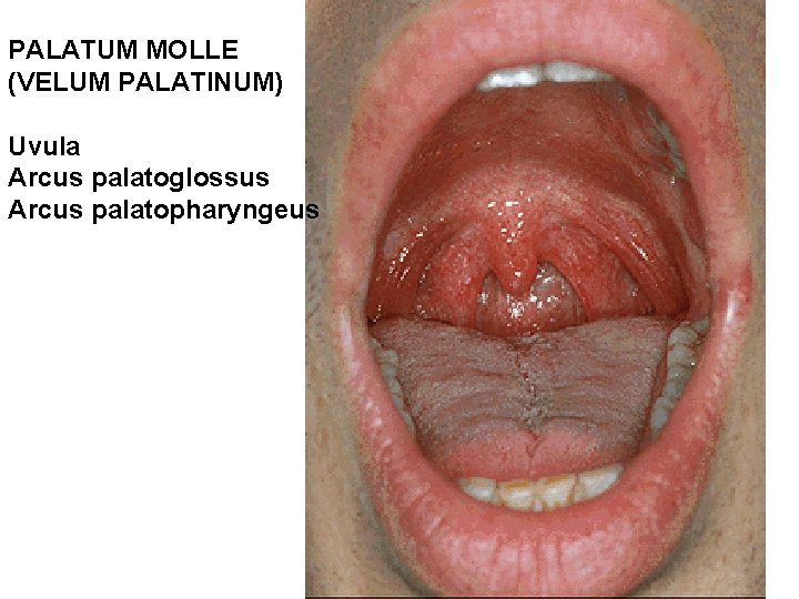 PALATUM MOLLE (VELUM PALATINUM) Uvula Arcus palatoglossus Arcus palatopharyngeus 