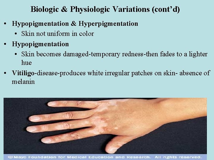 Biologic & Physiologic Variations (cont’d) • Hypopigmentation & Hyperpigmentation • Skin not uniform in