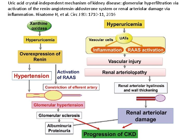 Uric acid crystal-independent mechanism of kidney disease: glomerular hyperfiltration via activation of the renin-angiotensin-aldosterone