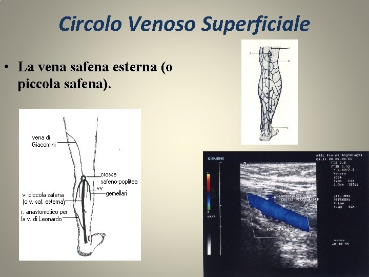 Circolo Venoso Superficiale • La vena safena esterna (o piccola safena). 