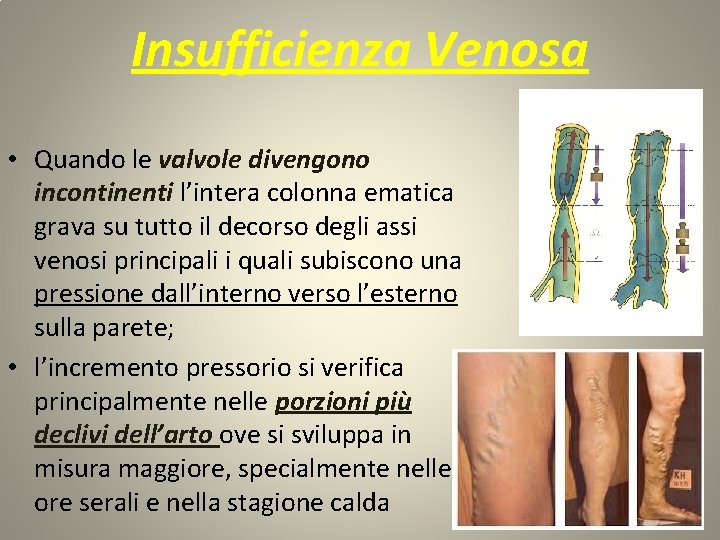 Insufficienza Venosa • Quando le valvole divengono incontinenti l’intera colonna ematica grava su tutto