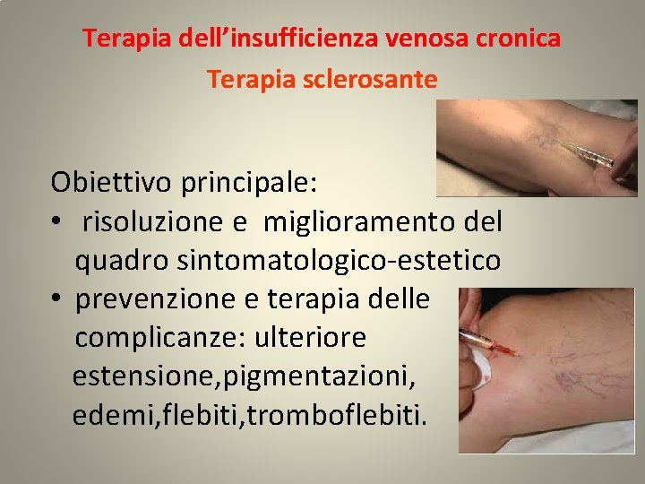 Terapia dell’insufficienza venosa cronica Terapia sclerosante Obiettivo principale: • risoluzione e miglioramento del quadro