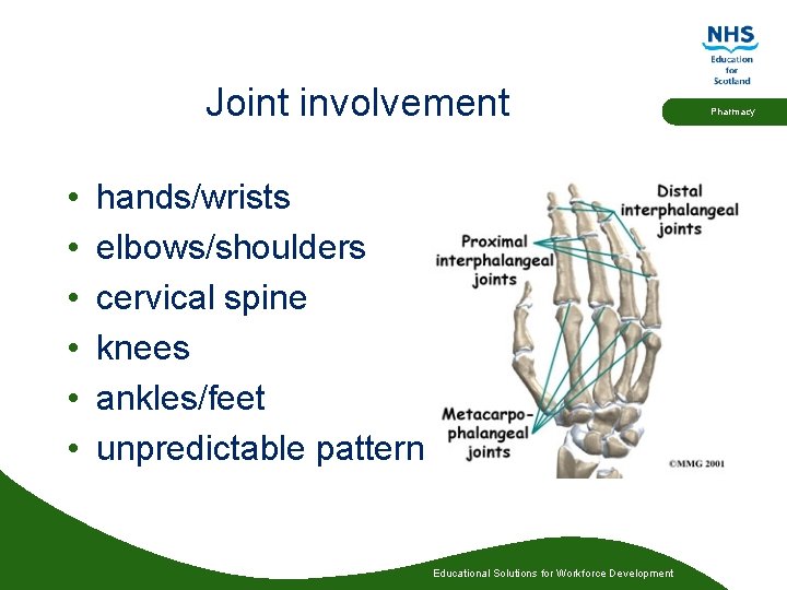 Joint involvement • • • hands/wrists elbows/shoulders cervical spine knees ankles/feet unpredictable pattern Educational