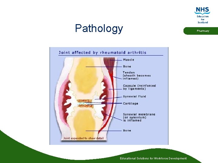 Pathology Educational Solutions for Workforce Development Pharmacy 