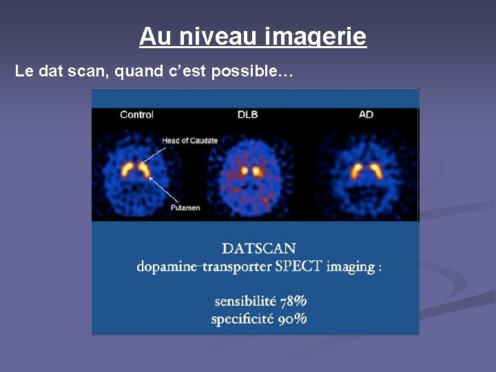 Au niveau imagerie Le dat scan, quand c’est possible… 