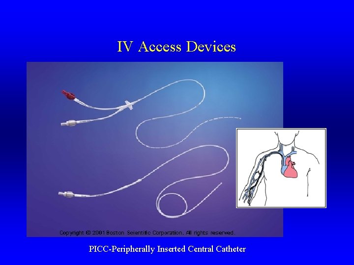 IV Access Devices PICC-Peripherally Inserted Central Catheter 