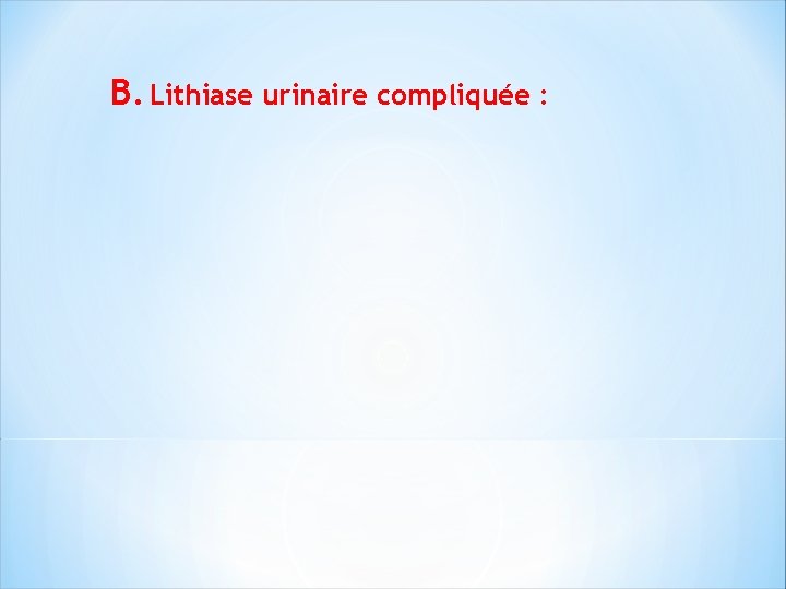 B. Lithiase urinaire compliquée : 