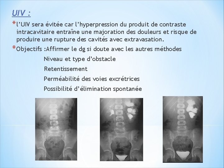 UIV : * l’UIV sera évitée car l’hyperpression du produit de contraste intracavitaire entraîne