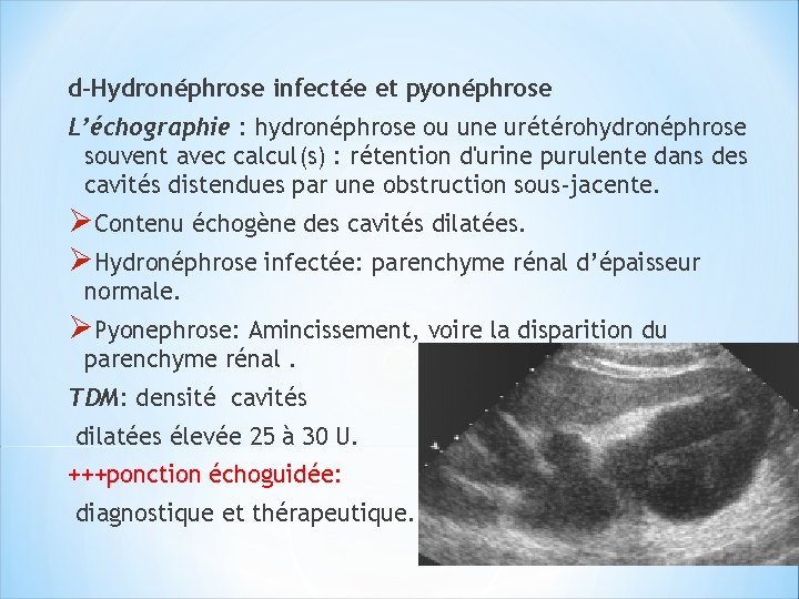 d-Hydronéphrose infectée et pyonéphrose L’échographie : hydronéphrose ou une urétérohydronéphrose souvent avec calcul(s) :