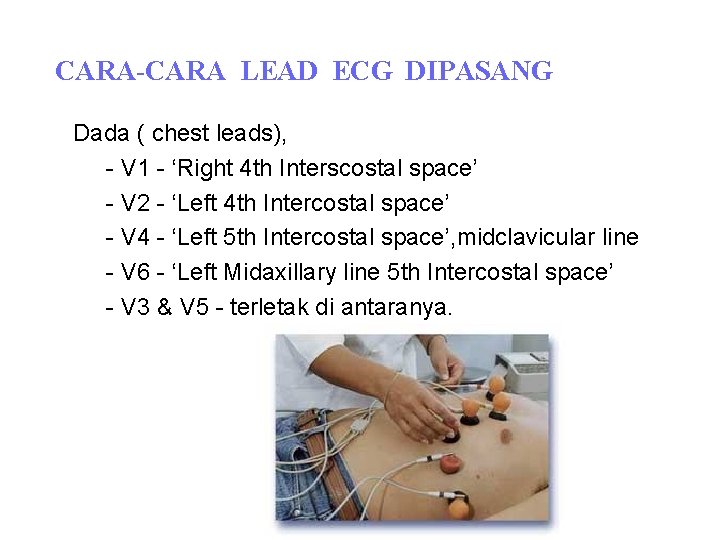 CARA-CARA LEAD ECG DIPASANG Dada ( chest leads), - V 1 - ‘Right 4 CARA-CARA LEAD ECG DIPASANG Dada ( chest leads), - V 1 - ‘Right 4