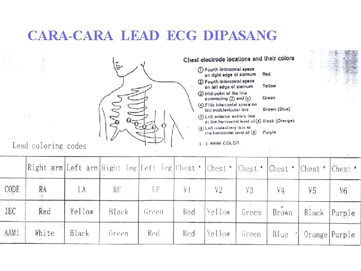 CARA-CARA LEAD ECG DIPASANG CARA-CARA LEAD ECG DIPASANG