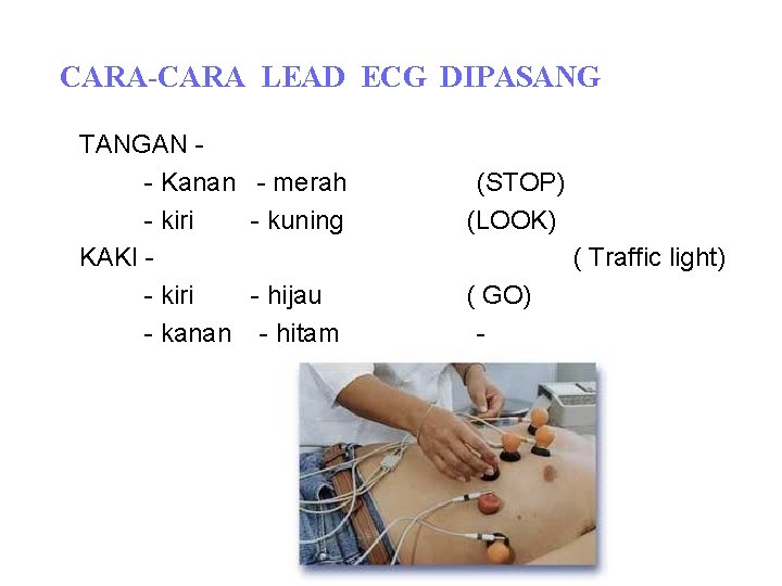 CARA-CARA LEAD ECG DIPASANG TANGAN - Kanan - kiri KAKI - kiri - kanan CARA-CARA LEAD ECG DIPASANG TANGAN - Kanan - kiri KAKI - kiri - kanan