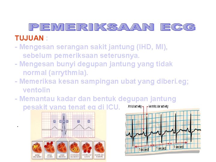 TUJUAN : - Mengesan serangan sakit jantung (IHD, MI), sebelum pemeriksaan seterusnya. - Mengesan TUJUAN : - Mengesan serangan sakit jantung (IHD, MI), sebelum pemeriksaan seterusnya. - Mengesan