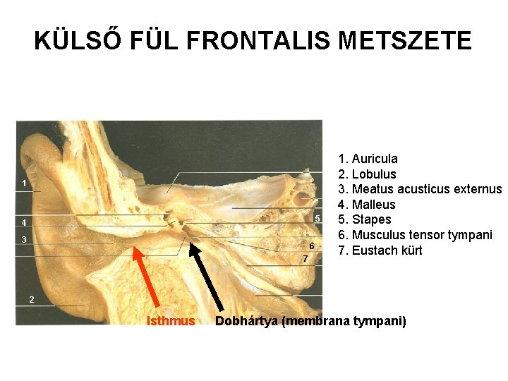 KÜLSŐ FÜL FRONTALIS METSZETE 1 5 4 3 6 7 1. Auricula 2. Lobulus