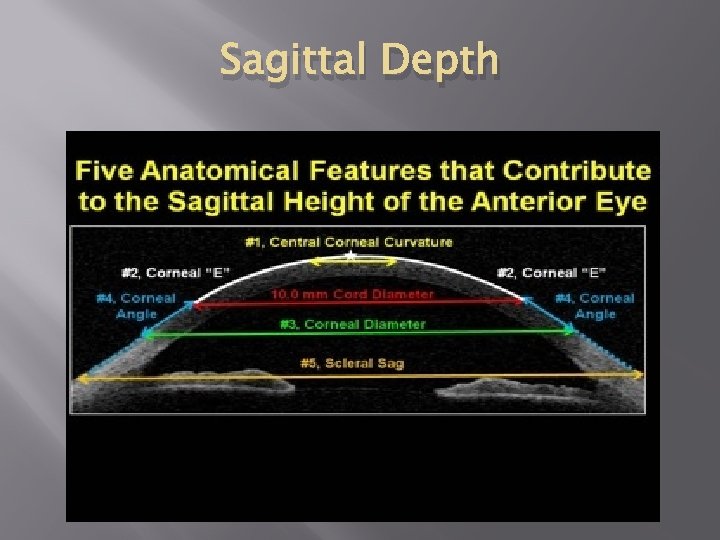 Sagittal Depth 