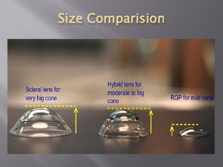 Size Comparision 