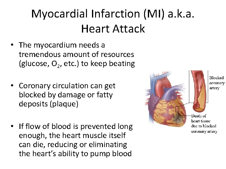 Myocardial Infarction (MI) a. k. a. Heart Attack • The myocardium needs a tremendous