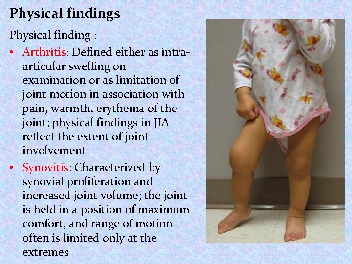 Physical findings Physical finding : • Arthritis: Defined either as intraarticular swelling on examination