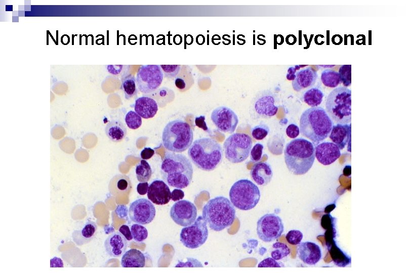Normal hematopoiesis is polyclonal Normal hematopoiesis is polyclonal