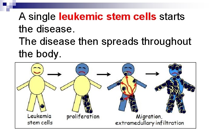 A single leukemic stem cells starts the disease. The disease then spreads throughout the