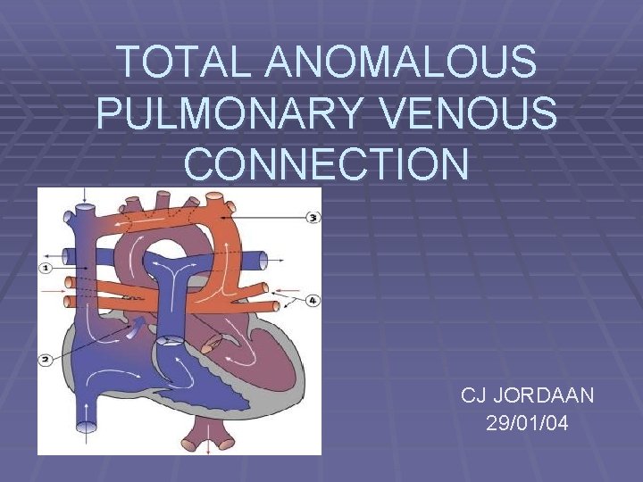 TOTAL ANOMALOUS PULMONARY VENOUS CONNECTION CJ JORDAAN 29/01/04 