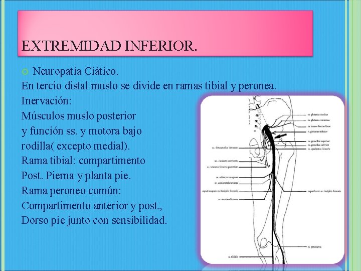 EXTREMIDAD INFERIOR. Neuropatía Ciático. En tercio distal muslo se divide en ramas tibial y