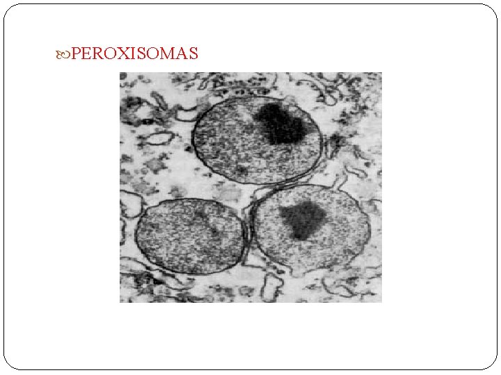  PEROXISOMAS 