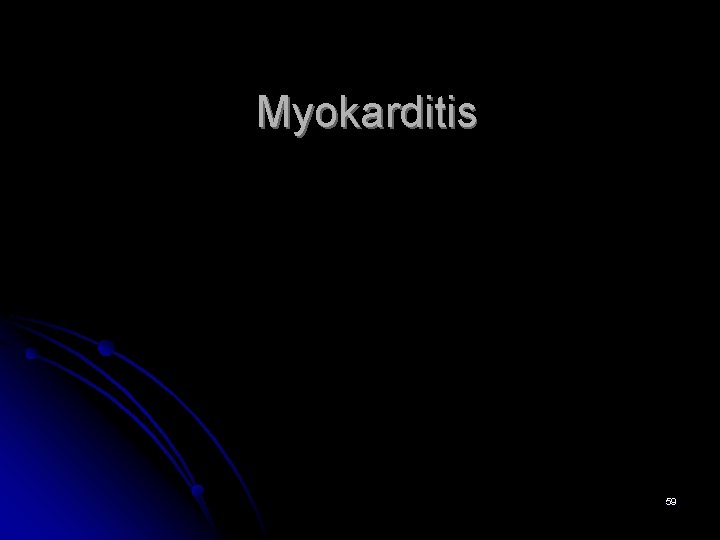 Myokarditis 59 