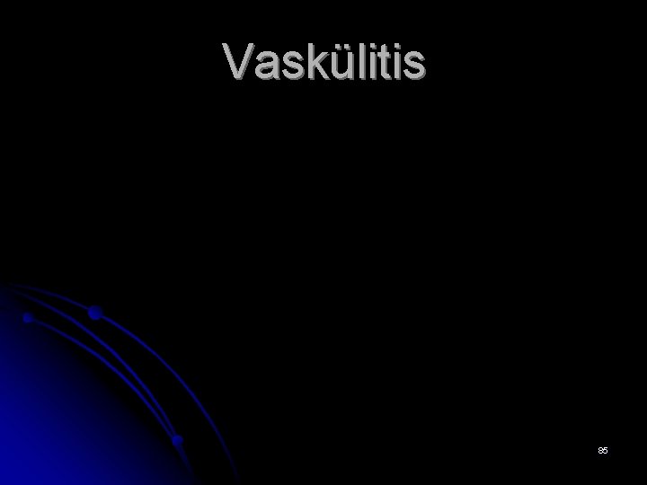 Vaskülitis 85 