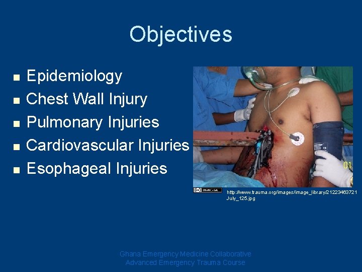 Objectives n n n Epidemiology Chest Wall Injury Pulmonary Injuries Cardiovascular Injuries Esophageal Injuries Objectives n n n Epidemiology Chest Wall Injury Pulmonary Injuries Cardiovascular Injuries Esophageal Injuries