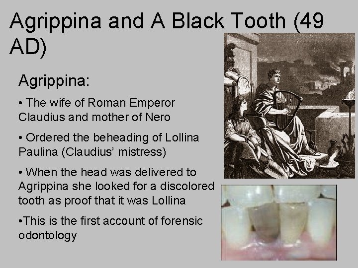 Agrippina and A Black Tooth (49 AD) Agrippina: • The wife of Roman Emperor