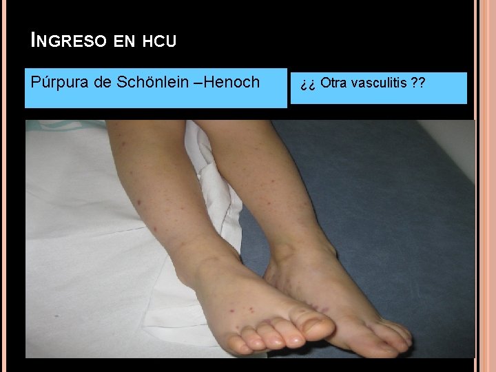 INGRESO EN HCU Púrpura de Schönlein –Henoch ¿¿ Otra vasculitis ? ? INGRESO EN HCU Púrpura de Schönlein –Henoch ¿¿ Otra vasculitis ? ?
