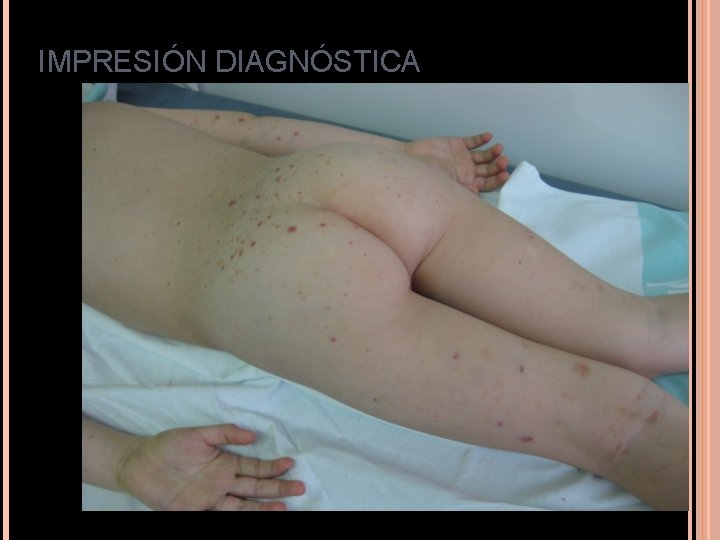 IMPRESIÓN DIAGNÓSTICA IMPRESIÓN DIAGNÓSTICA