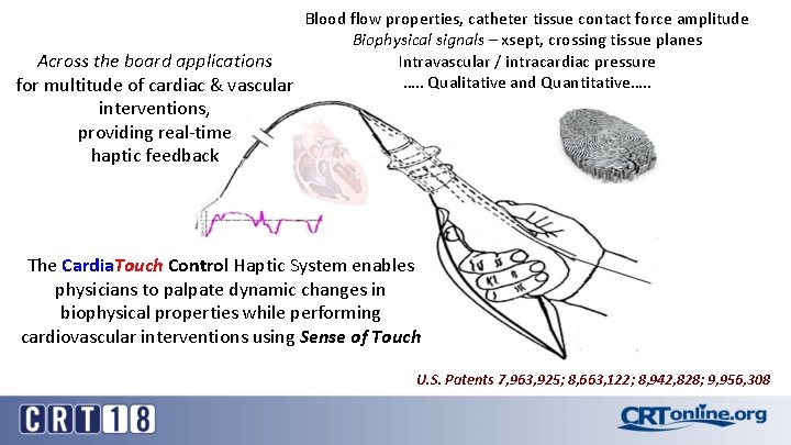 Blood flow properties, catheter tissue contact force amplitude Biophysical signals – xsept, crossing tissue Blood flow properties, catheter tissue contact force amplitude Biophysical signals – xsept, crossing tissue