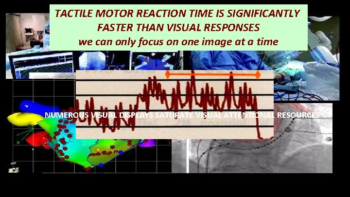 TACTILE MOTOR REACTION TIME IS SIGNIFICANTLY FASTER THAN VISUAL RESPONSES we can only focus TACTILE MOTOR REACTION TIME IS SIGNIFICANTLY FASTER THAN VISUAL RESPONSES we can only focus