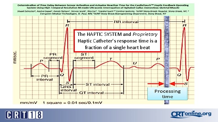 The HAPTIC SYSTEM and Proprietary Haptic Catheter’s response time is a fraction of a The HAPTIC SYSTEM and Proprietary Haptic Catheter’s response time is a fraction of a