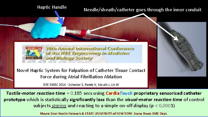 Haptic Handle Needle/sheath/catheter goes through the inner conduit Novel Haptic System for Palpation of Haptic Handle Needle/sheath/catheter goes through the inner conduit Novel Haptic System for Palpation of