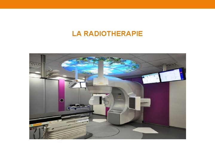 LA RADIOTHERAPIE EXTERNE la 