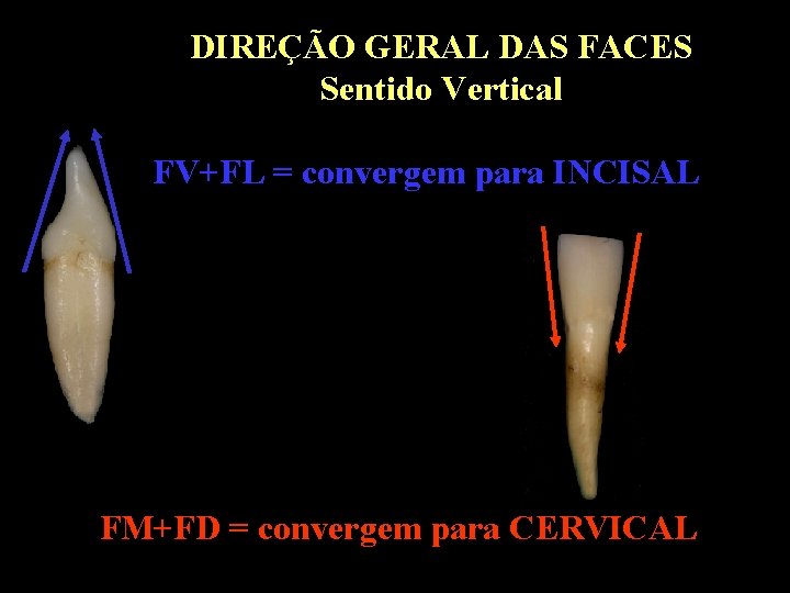DIREÇÃO GERAL DAS FACES Sentido Vertical FV+FL = convergem para INCISAL FM+FD = convergem DIREÇÃO GERAL DAS FACES Sentido Vertical FV+FL = convergem para INCISAL FM+FD = convergem