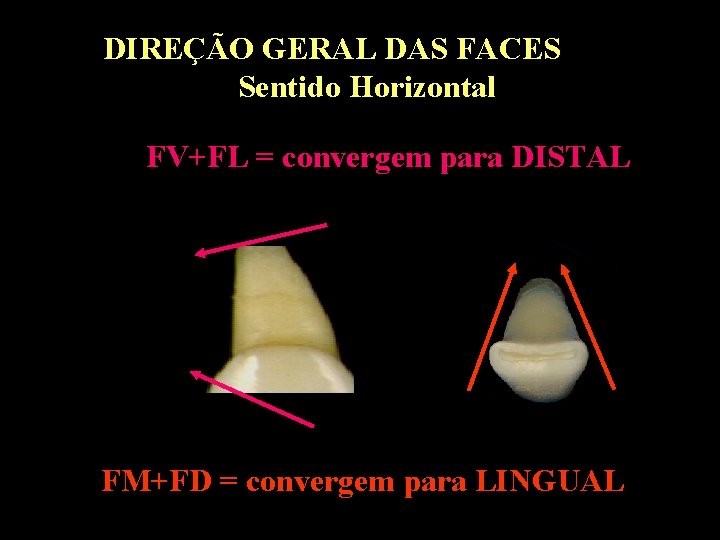 DIREÇÃO GERAL DAS FACES Sentido Horizontal FV+FL = convergem para DISTAL FM+FD = convergem DIREÇÃO GERAL DAS FACES Sentido Horizontal FV+FL = convergem para DISTAL FM+FD = convergem