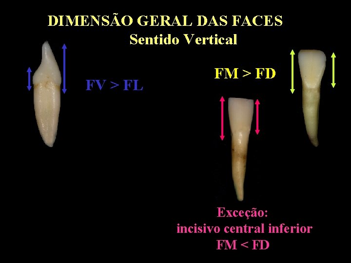DIMENSÃO GERAL DAS FACES Sentido Vertical FV > FL FM > FD Exceção: incisivo DIMENSÃO GERAL DAS FACES Sentido Vertical FV > FL FM > FD Exceção: incisivo