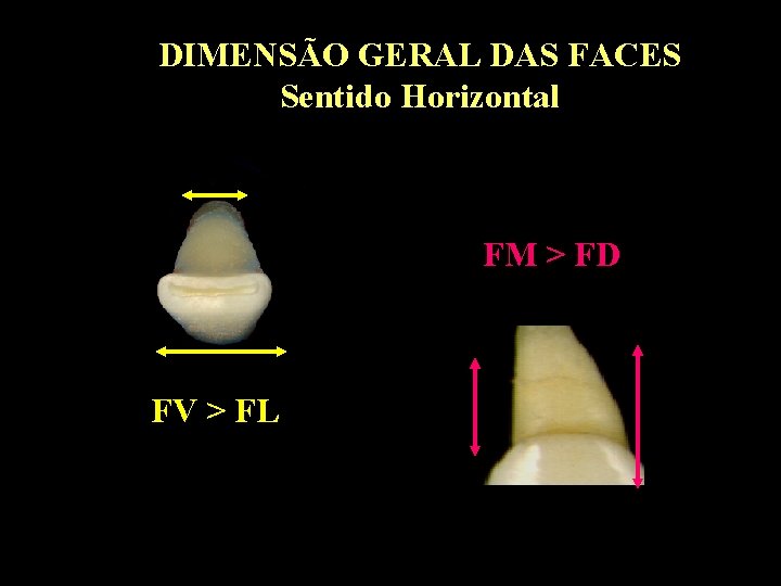 DIMENSÃO GERAL DAS FACES Sentido Horizontal FM > FD FV > FL DIMENSÃO GERAL DAS FACES Sentido Horizontal FM > FD FV > FL