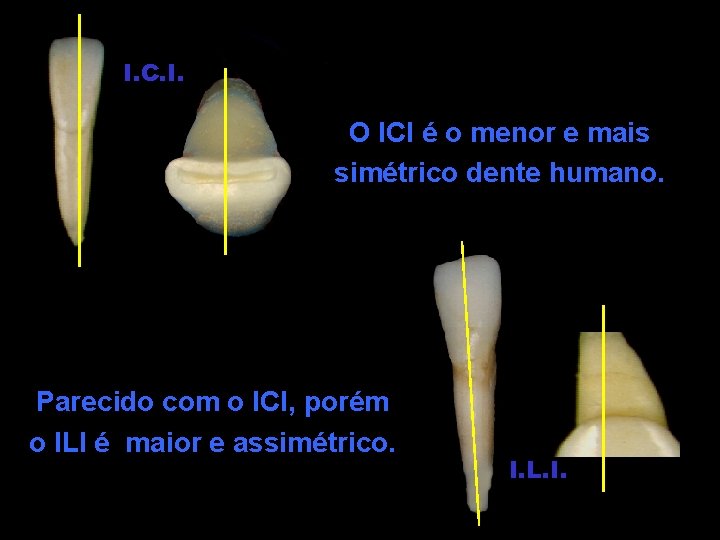I. C. I. O ICI é o menor e mais simétrico dente humano. Parecido I. C. I. O ICI é o menor e mais simétrico dente humano. Parecido