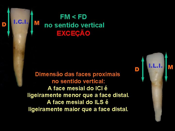 D FM < FD I. C. I. M no sentido vertical EXCEÇÃO Dimensão das D FM < FD I. C. I. M no sentido vertical EXCEÇÃO Dimensão das