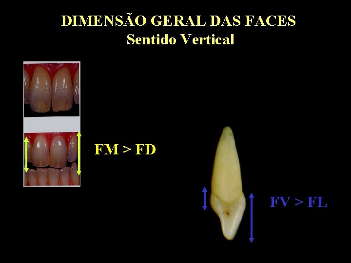 DIMENSÃO GERAL DAS FACES Sentido Vertical FM > FD FV > FL DIMENSÃO GERAL DAS FACES Sentido Vertical FM > FD FV > FL