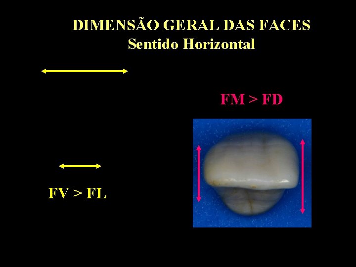 DIMENSÃO GERAL DAS FACES Sentido Horizontal FM > FD FV > FL DIMENSÃO GERAL DAS FACES Sentido Horizontal FM > FD FV > FL