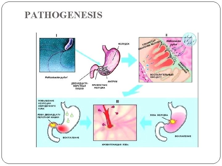 PATHOGENESIS 