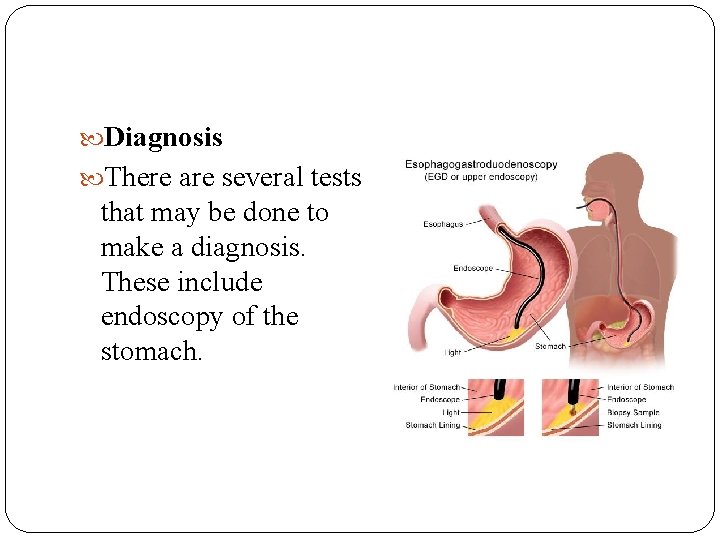 Diagnosis There are several tests that may be done to make a diagnosis. Diagnosis There are several tests that may be done to make a diagnosis.