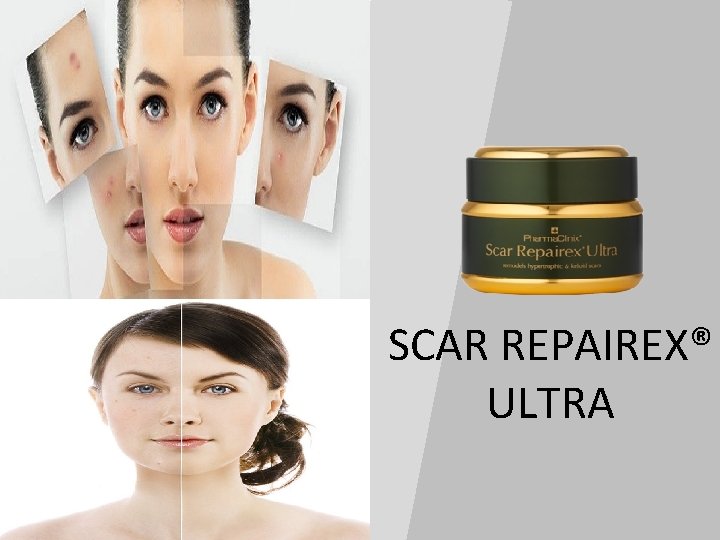 SCAR REPAIREX® ULTRA 